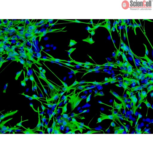 Human Astrocyte Cell_HA-bs