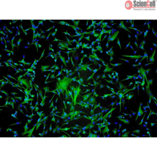 Human Astrocyte Cell_HA-sp