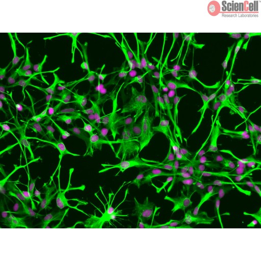 Human Astrocyte Cell_HA