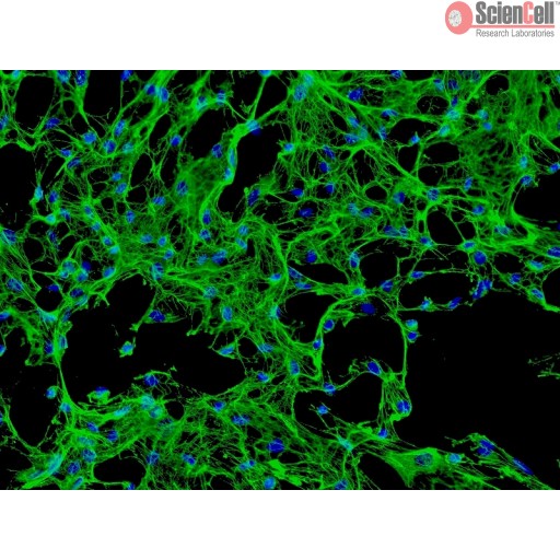 Human Osteoblasts Cell_HCO